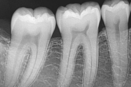 Radiografias dentales